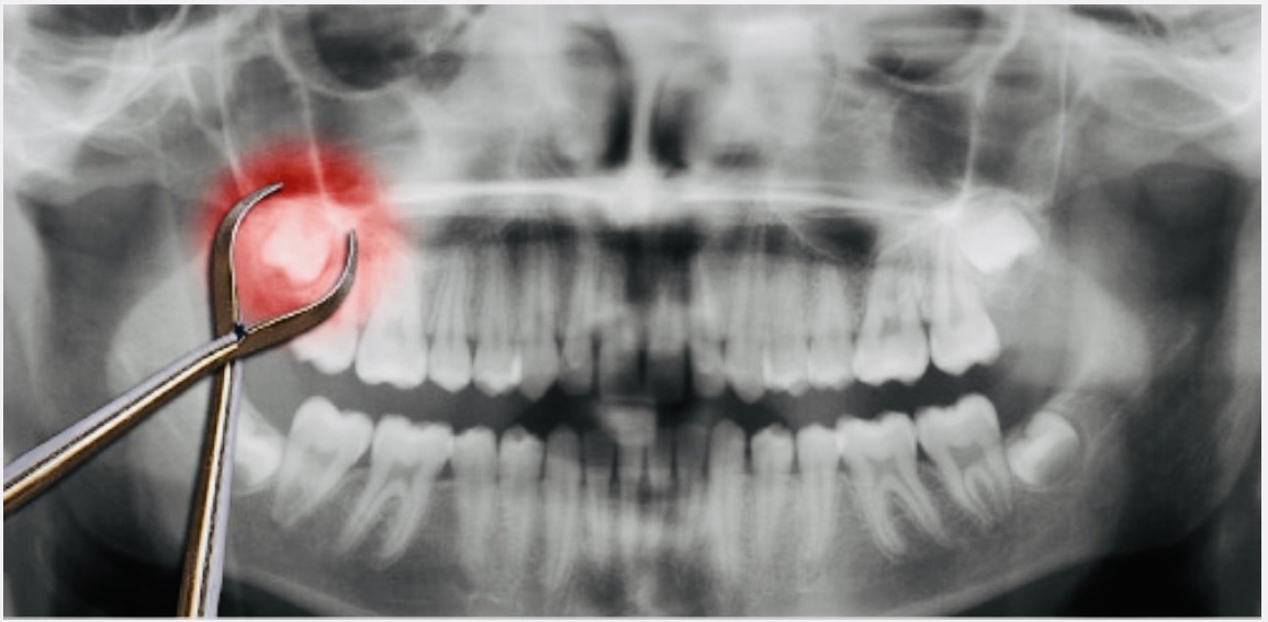 佐賀市の「池田歯科こども歯科」