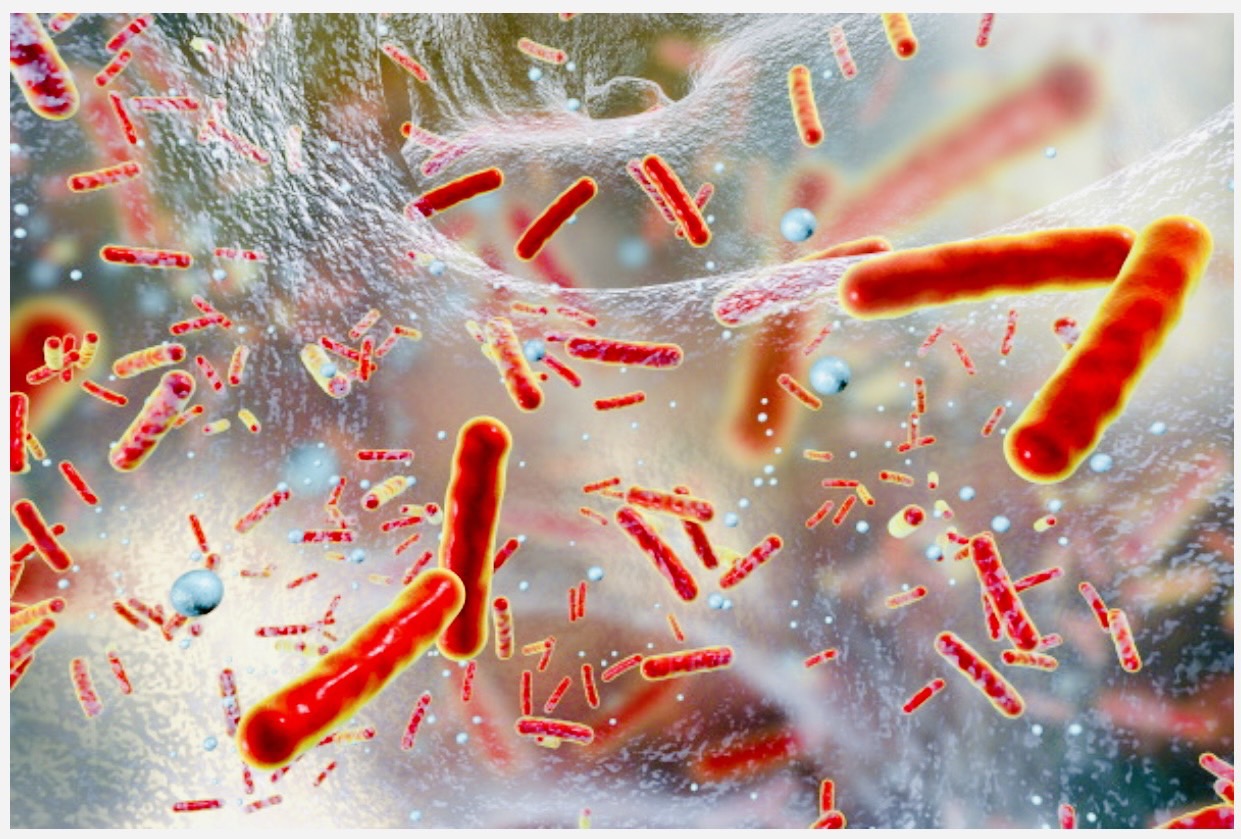 佐賀市の歯医者、池田歯科こども歯科で歯周病治療