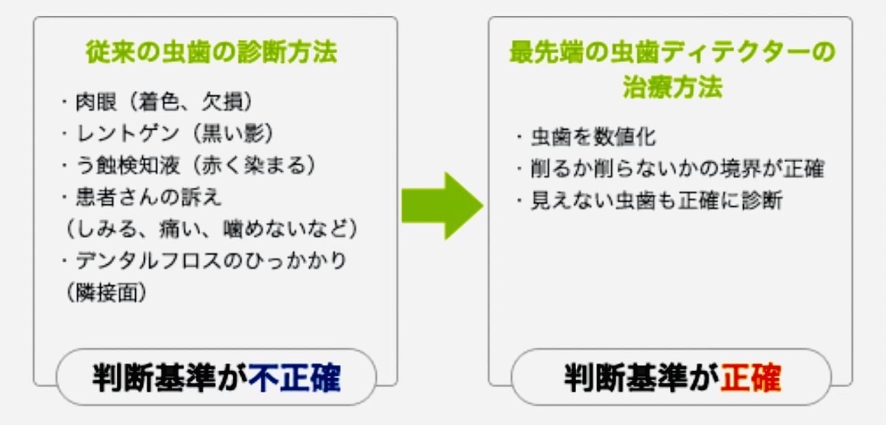 佐賀市の歯医者、池田歯科こども歯科でむし歯治療