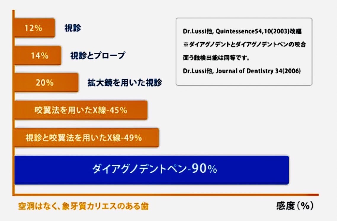 佐賀市の歯医者、池田歯科こども歯科でむし歯治療