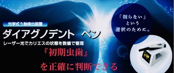 佐賀市の歯医者、池田歯科こども歯科でむし歯治療