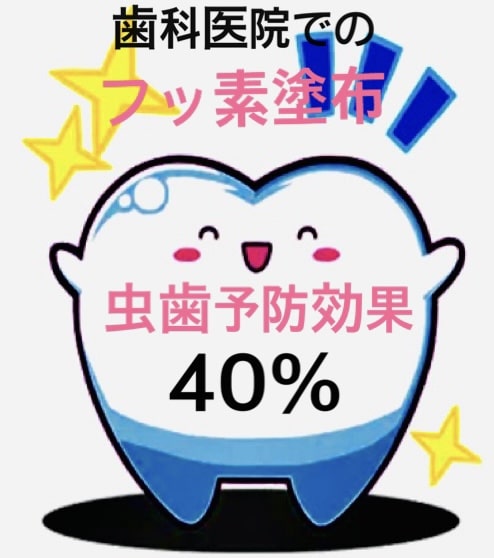 佐賀市の歯医者、池田歯科こども歯科でむし歯治療