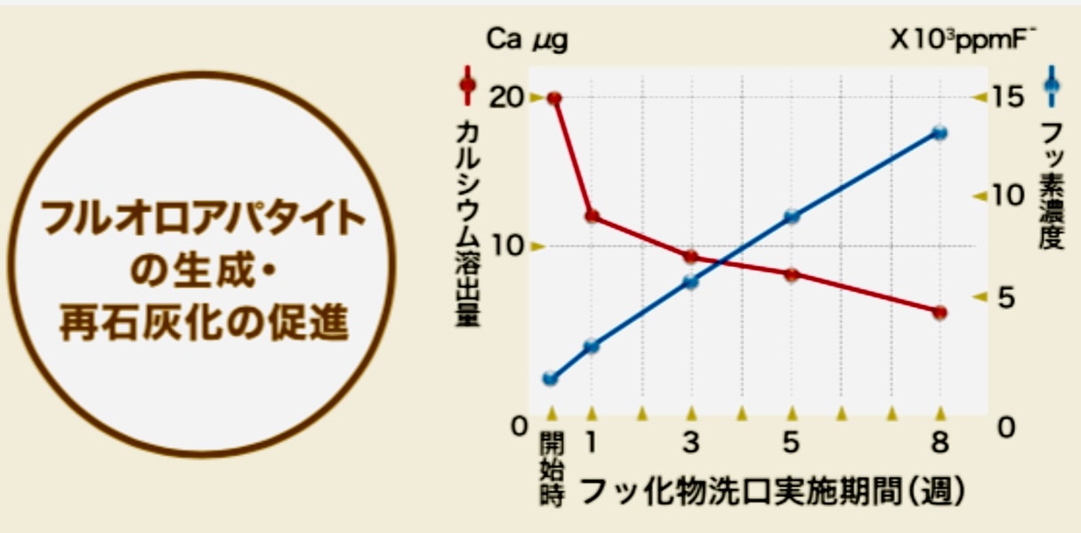 佐賀市の歯医者、池田歯科こども歯科でむし歯治療