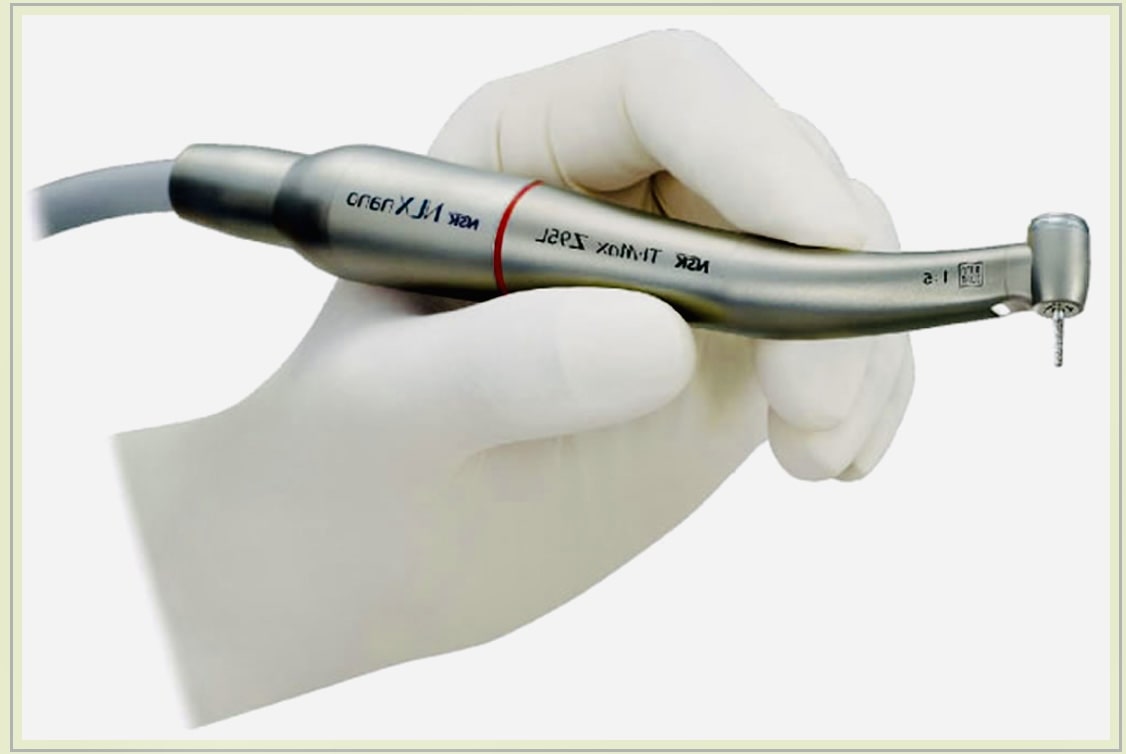 佐賀市の歯医者、池田歯科こども歯科でむし歯治療