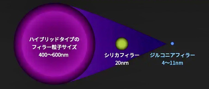 佐賀市の歯医者、池田歯科こども歯科でむし歯治療