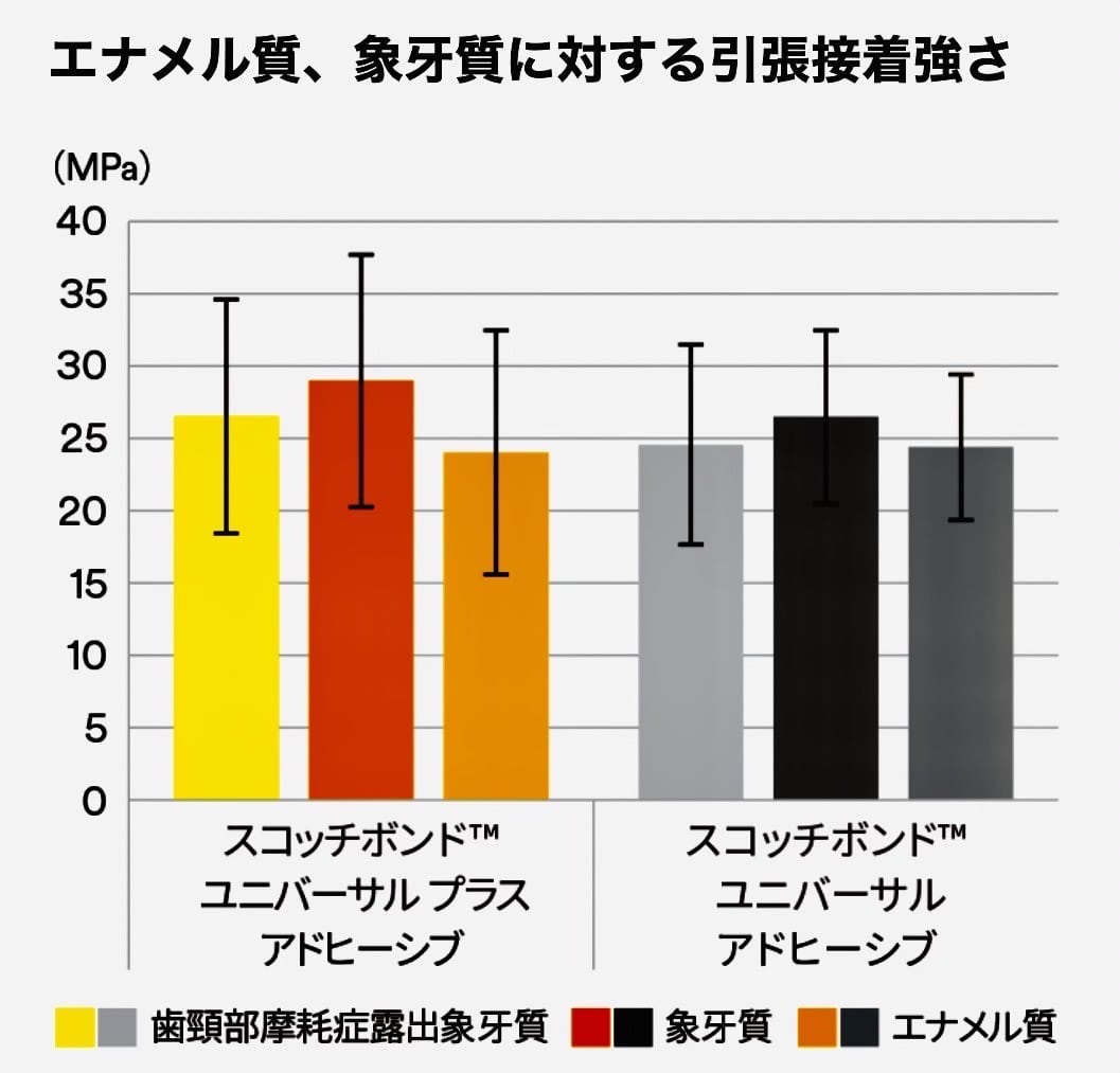 佐賀市の歯医者、池田歯科こども歯科でむし歯治療
