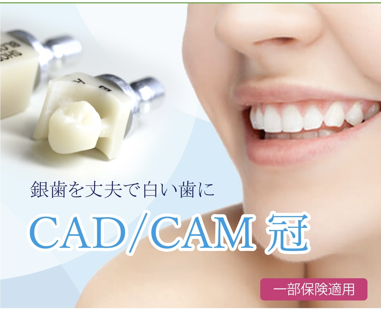 佐賀市の歯医者、池田歯科こども歯科でむし歯治療