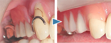 船堀(東京都江戸川区)の歯医者で予防歯科