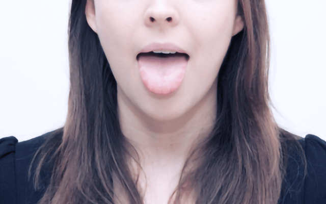 佐賀市の歯医者、池田歯科こども歯科で舌痛症の治療