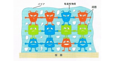 佐賀市の歯医者、池田歯科こども歯科の口臭専門外来