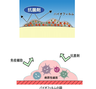 佐賀市の歯医者、池田歯科こども歯科の口臭専門外来