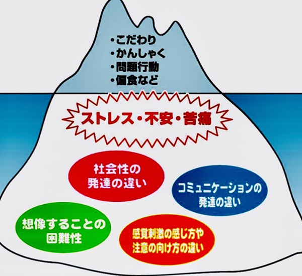 佐賀市の歯医者、池田歯科こども歯科でむし歯治療