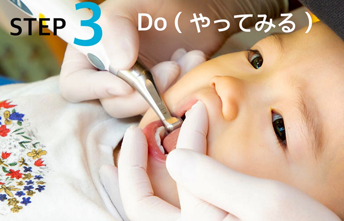 佐賀市の歯医者、池田歯科こども歯科でむし歯治療