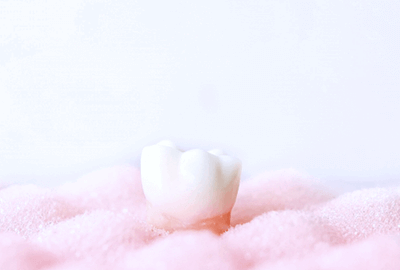 佐賀市の歯医者、池田歯科こども歯科で親知らずの抜歯